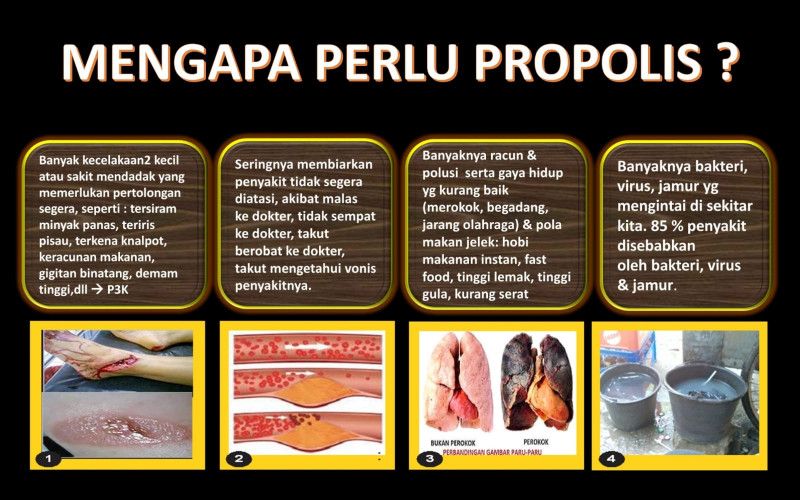 First slide
